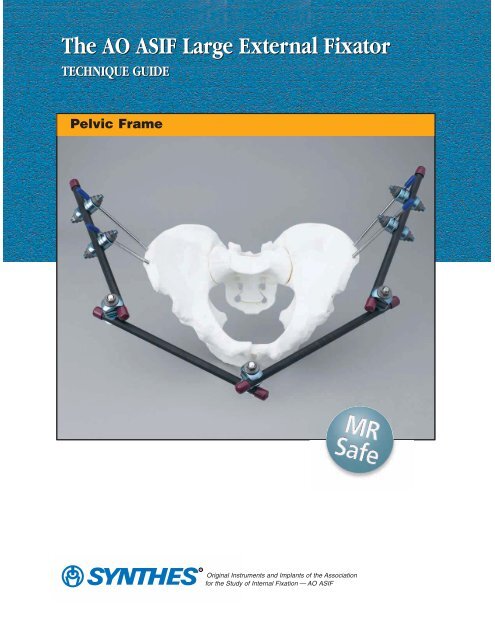 The AO ASIF Large External Fixator-Pelvic Frame Technique Guide