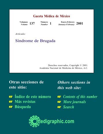 Síndrome de Brugada - edigraphic.com