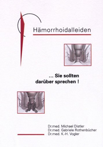 Hämorrhoiden Broschüre