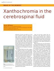 Xanthochromia in the cerebrospinal fluid - Practical Neurology