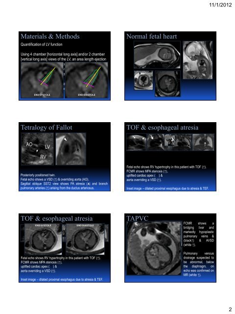Pseudo ECG-gating in fetal cardiac MRI