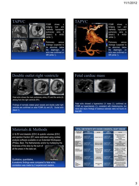 Pseudo ECG-gating in fetal cardiac MRI