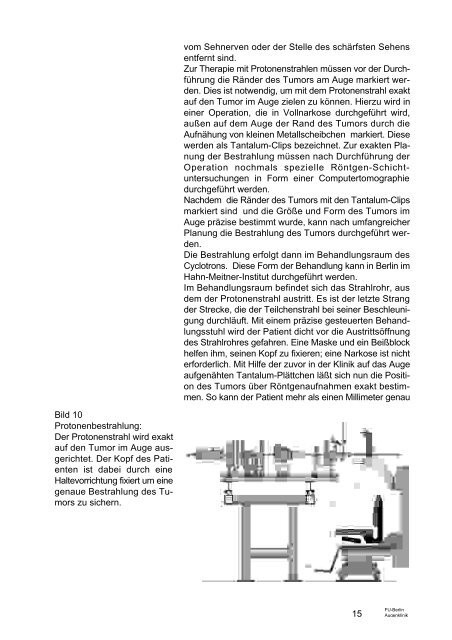 FU Berlin DAS MALIGNE ADERHAUTMELANOM - Augenärzte Thun ...