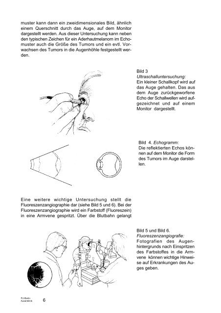 FU Berlin DAS MALIGNE ADERHAUTMELANOM - Augenärzte Thun ...