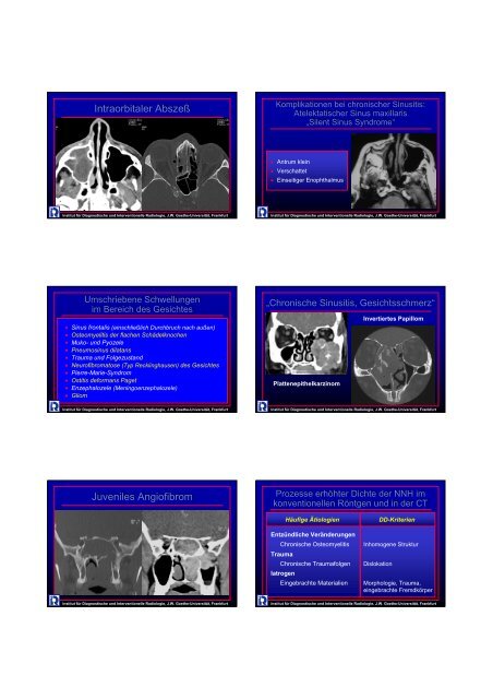 MDCT der Nasennebenhöhlen - Institut für Diagnostische und ...