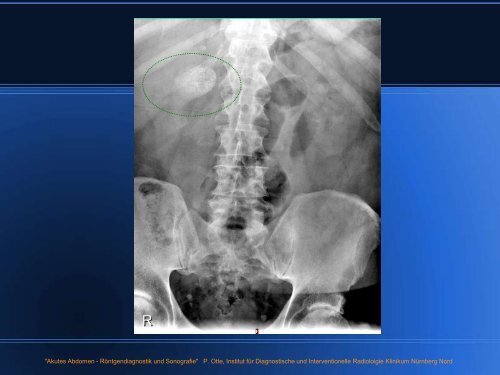 Das akute Abdomen Röntgendiagnostik und Sonografie