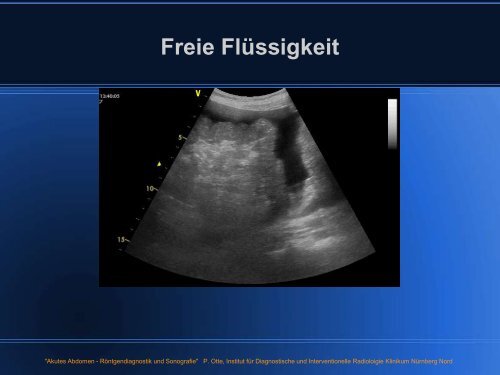 Freie Flüssigkeit Im Kleinen Becken Ursache www.yumpu.com