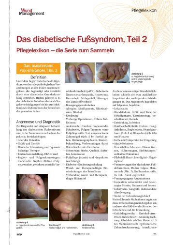 Das diabetische Fußsyndrom, Teil 2 - Werner Sellmer