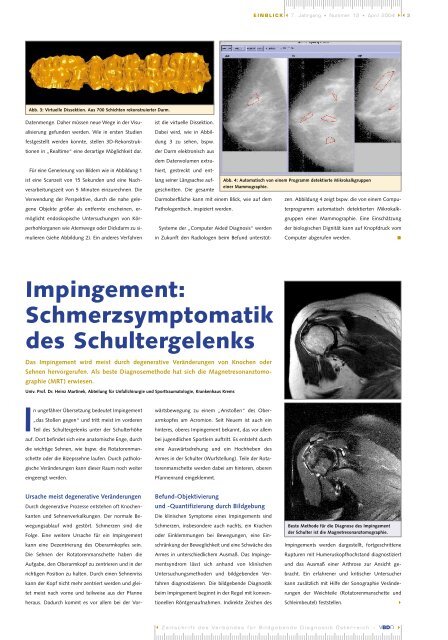 Impingement - Verband für Bildgebende Diagnostik Österreich