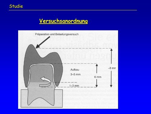 Aufbau von vitalen Zähnen