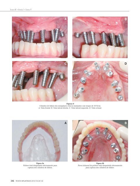 7520-Revista V.7-n.3.indd - CLINICA DE ESTOMATOLOGIA ...