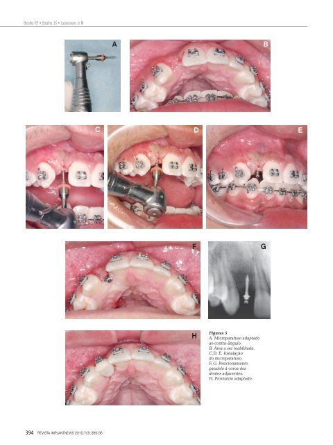 7520-Revista V.7-n.3.indd - CLINICA DE ESTOMATOLOGIA ...