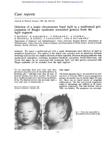 Deletion of a single chromosome band 4q26 in a malformed girl ...