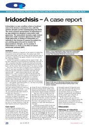 Iridoschisis - A case report - Pesudovs