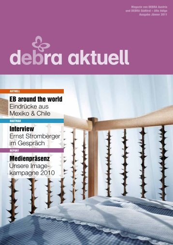 eb ra aktuell - DEBRA Austria