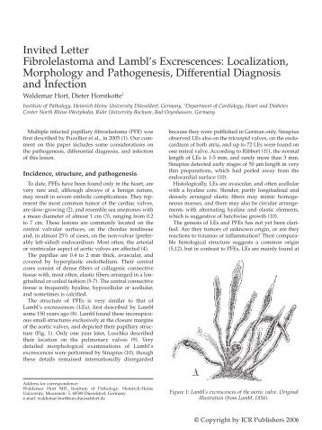 Invited Letter Fibrolelastoma and Lambl's Excrescences ... - Icr-heart