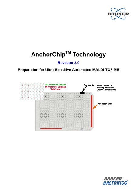 AnchorChip Technology 2.0