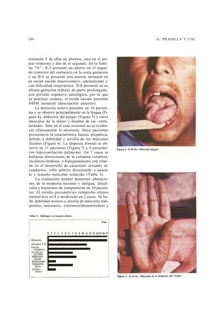 DISTROFIA MUSCULAR MIOTONICA - Acta Médica Colombiana