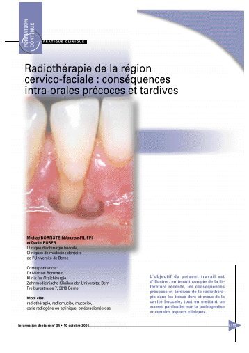 Radiothérapie de la région cervico-faciale - Information dentaire