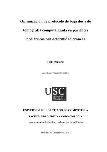 Tesis craneosinostosis.pdf