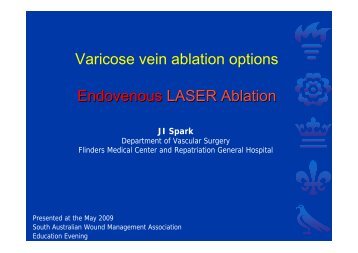 Varicose vein ablation options Endovenous LASER Ablation - AWMA