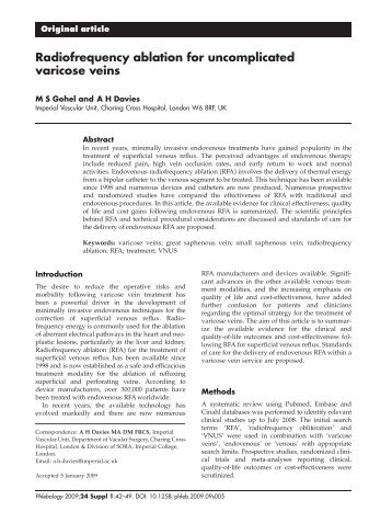 Radiofrequency ablation for uncomplicated varicose veins