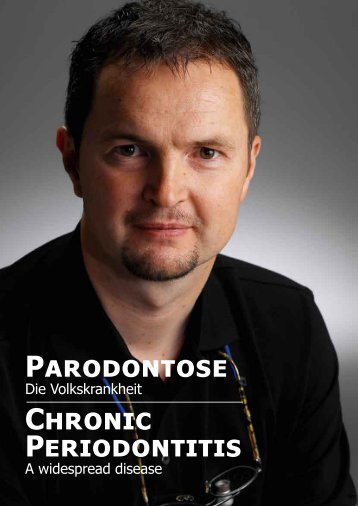 Parodontose Chronic Periodontitis - Zahnarzt Prof. Dr. Michael Rosin