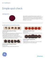 Neonatal Screening Simple Spot Check - Whatman