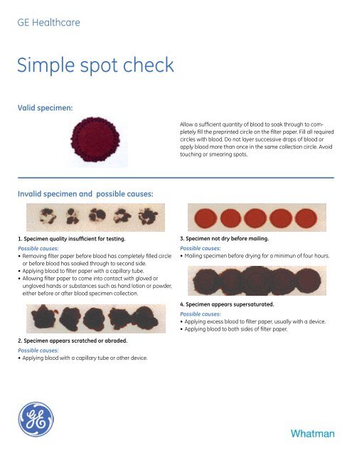 Blood Specimen Collection Chart