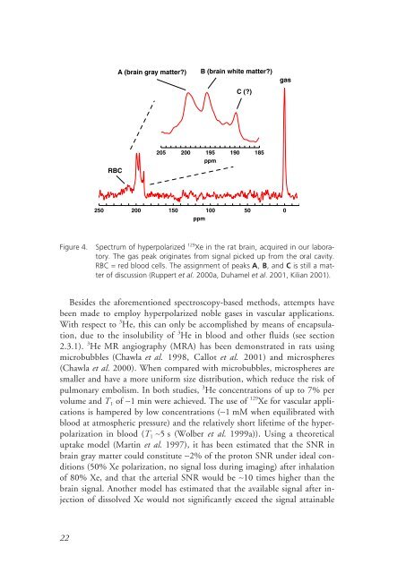 Hyperpolarized Nuclei for NMR Imaging and Spectroscopy - Lunds ...