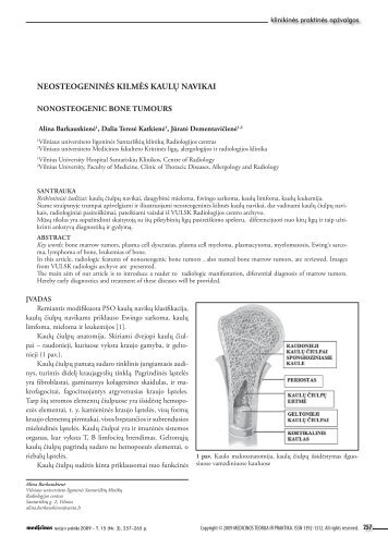 neosteogeninės kilmės kaulų navikai - Medicinos teorija ir praktika
