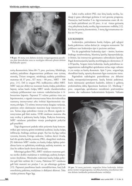 neosteogeninės kilmės kaulų navikai - Medicinos teorija ir praktika
