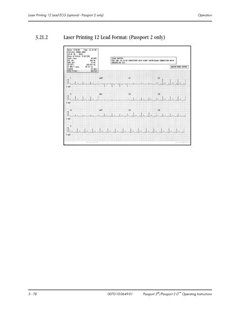 Datascope Passport - Mindray