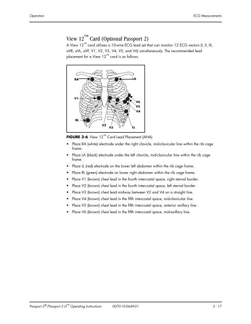 Datascope Passport - Mindray