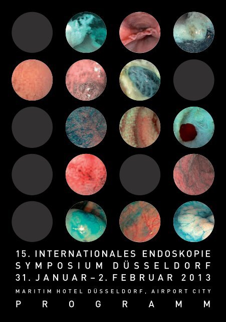 Programm - 15th Düsseldorf International Endoskopie Symposium