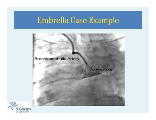 Stroke During TAVI: An Unmet Clinical Need? - Paragon Conventions