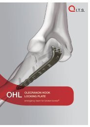 OHL OLECRANON HOOK LOCKING PLATE - ITS-Implant.com
