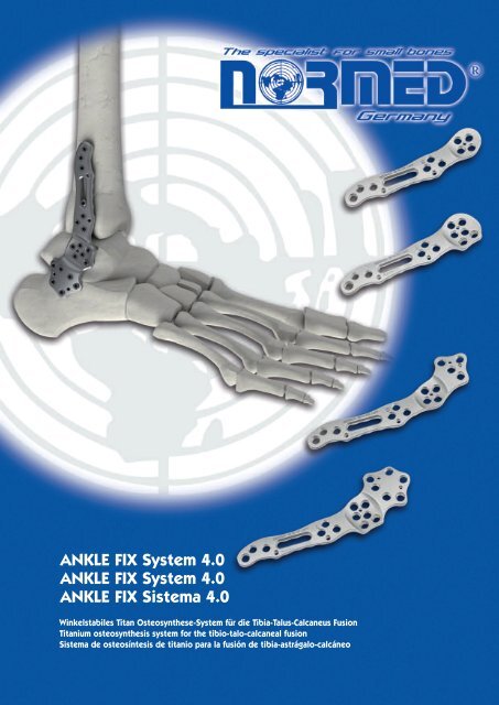 ANKLE FIX System 4.0 ANKLE FIX System 4.0 ... - Stratmed.co.za