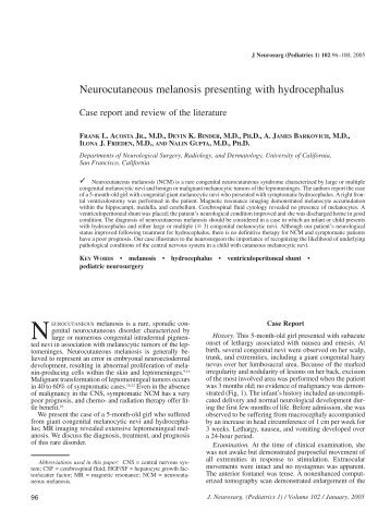 Neurocutaneous melanosis presenting with hydrocephalus