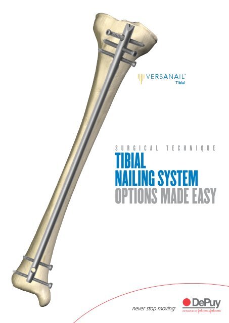 VERSANAIL Tibial Nailing System Surgical Technique - Biomet