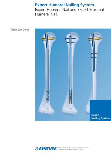 Expert Humeral Nailing System. Expert Humeral Nail and ... - Synthes