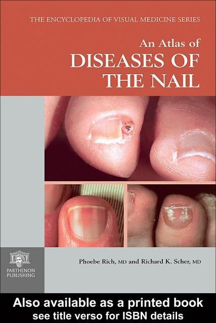 Atlas of Diseases of the Nail - DermaAmin