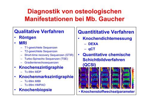 Knochen und Morbus Gaucher