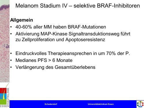 Melanom - Universitätsklinikum Essen