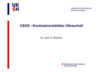 CEUS - Kontrastverstärkter Ultraschall - Medizinische Klinik I