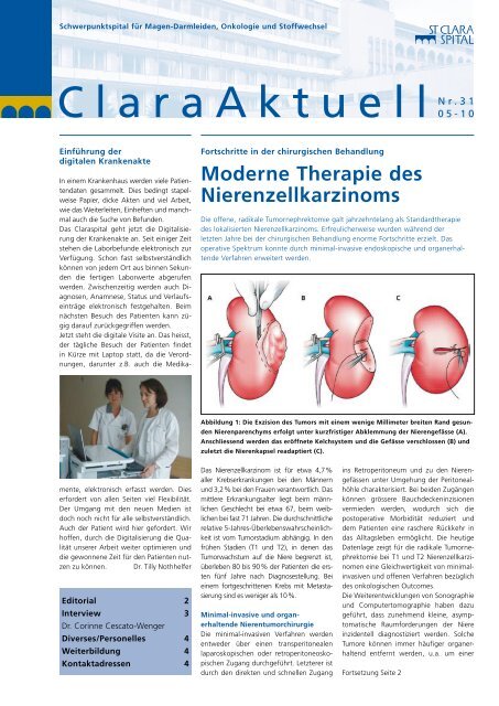 Moderne Therapie des Nierenzellkarzinoms - Claraspital