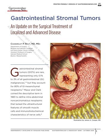 Gastrointestinal Stromal Tumors - Gastroenterology & Endoscopy ...