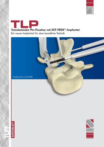 translaminäre Pin-Fixation mit eCF-PeeK - SIGNUS Medizintechnik ...