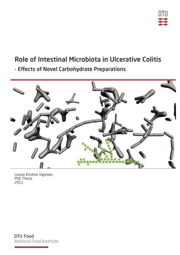 Role of Intestinal Microbiota in Ulcerative Colitis