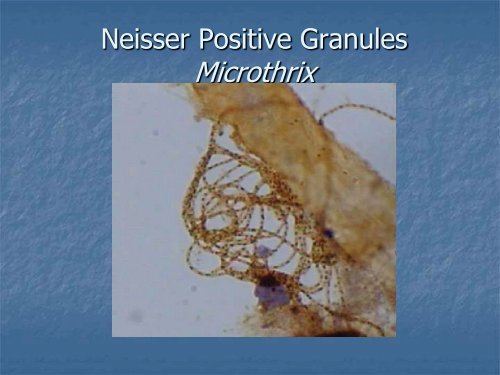 Identification and Control of Filamentous Bacteria